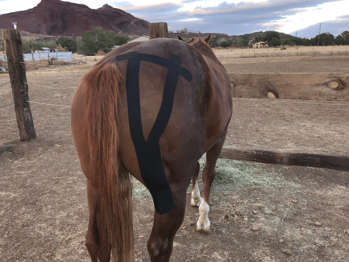 Kinesiology Taping -- semitendonosis/biceps femoris support