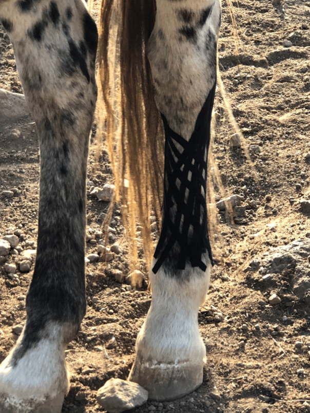 Kinesiology Taping -- inflammation reduction
