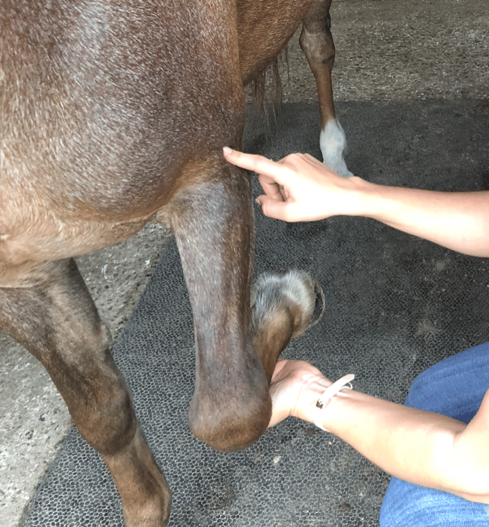 Acupressure