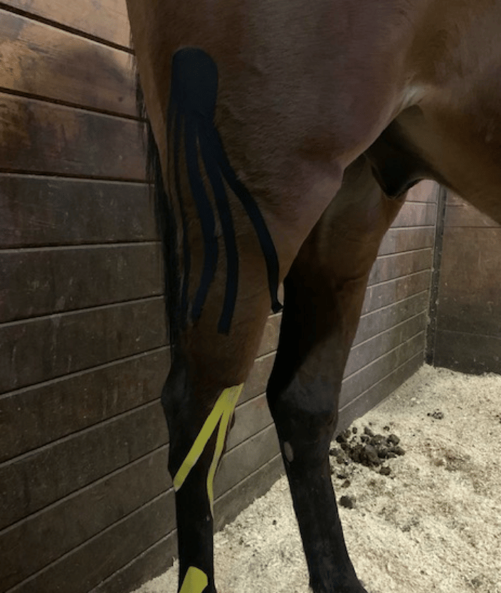 Kinesiology Taping