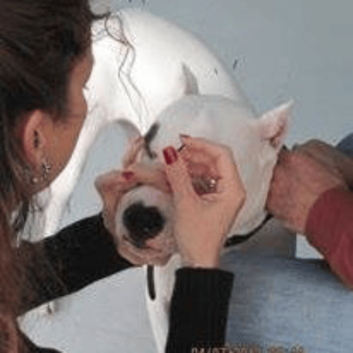 Acupuncture
