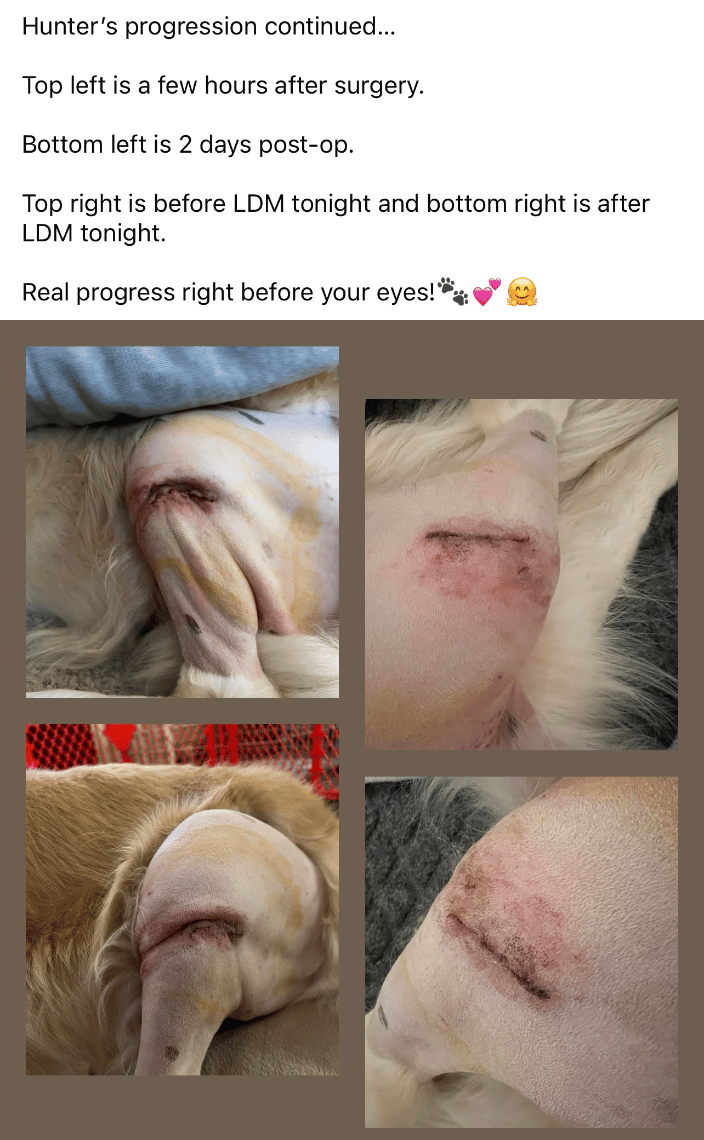 CCL Repair massage therapy results